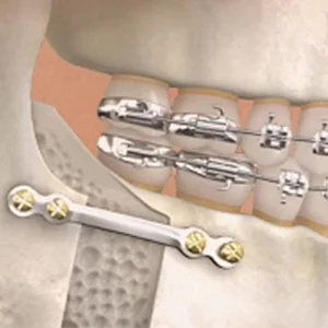 tooth extraction near me