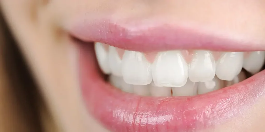 dental crown cost