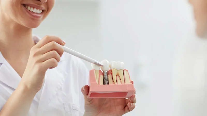 invisalign retainer
